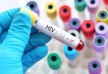 HIV – o problema actuala