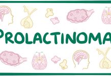 Ce este prolactinomul?