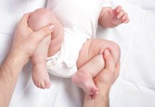 Luxatia congenitala de sold