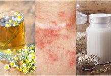5 remedii la domiciliu pentru a trata dermatita de contact