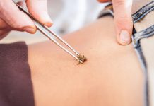 Apiterapia sau terapia cu albine: ce este si la ce se utilizeaza?