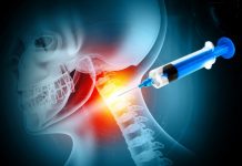 Infiltratiile in coloana (spinale): cand sunt recomandate